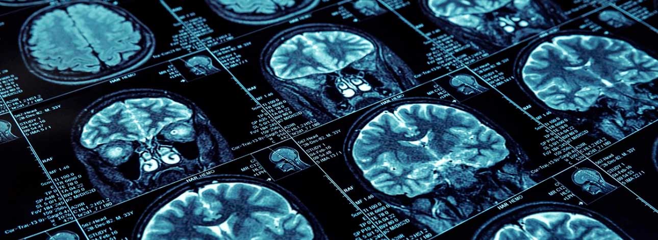 spx-clinica-spx-imagem-ressonancia-magnetica-na-spx-sta-capa