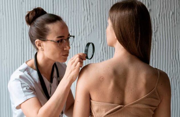 spx-clinica-spx-imagem-celulas-mutantes-no-cancer-de-pele