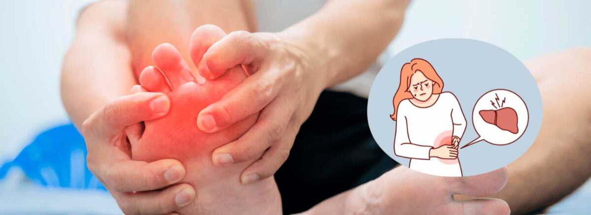 spx-clinica-spx-imagem-pes-inchados-indicam-problema-no-figado