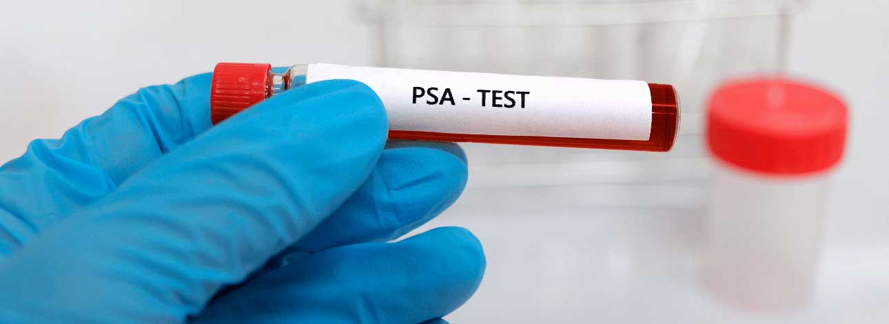 spx-clinica-spx-imagem-comparativo-dobro-de-casos-de-cancer-de-prostata