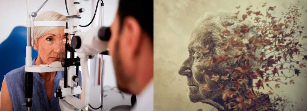 spx-clinica-spx-imagem-saude-dos-olhos-pode-prever-alzheimer