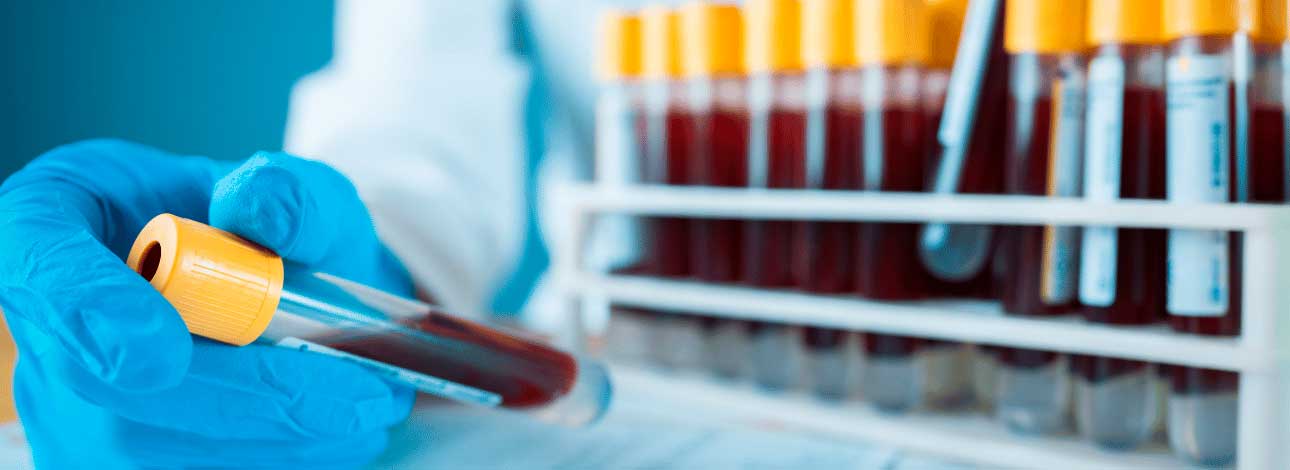 spx-clinica-spx-imagem-tipos-de-cancer-exame-de-sangue-com-ia