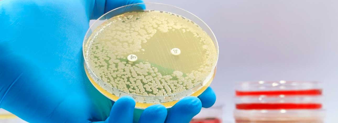 spx-clinica-spx-imagem-combate-substancias-contra-bacterias