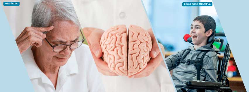 spx-clinica-spx-imagem-doencas-neurodegenerativas-tecnologia-icobrain