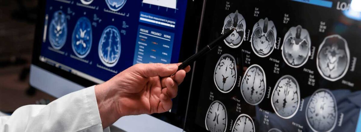 spx-clinica-spx-imagem-exame-pode-detectar-demencia
