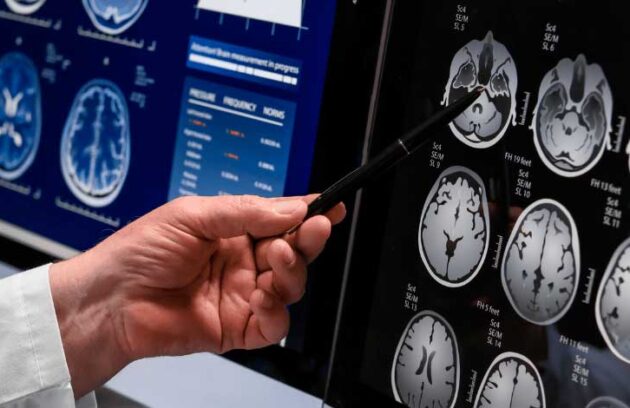 spx-clinica-spx-imagem-exame-pode-detectar-demencia