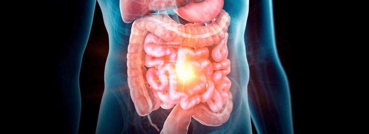 spx-clinica-spx-imagem-feridas-na-pele-podem-impactar-o-intestino