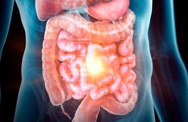 spx-clinica-spx-imagem-feridas-na-pele-podem-impactar-o-intestino