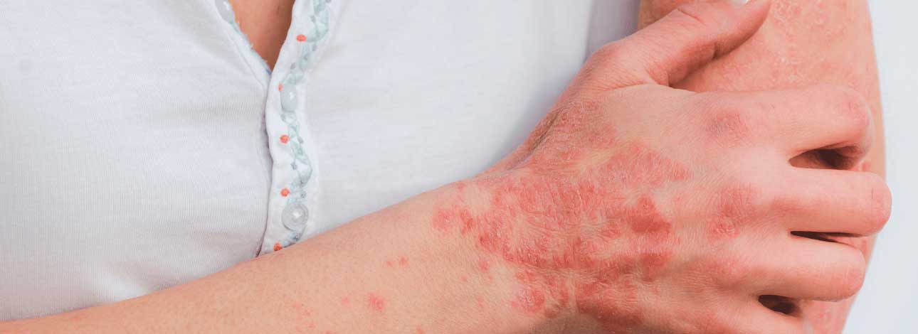 spx-clinica-spx-imagem-principais-doencas-dermatologia