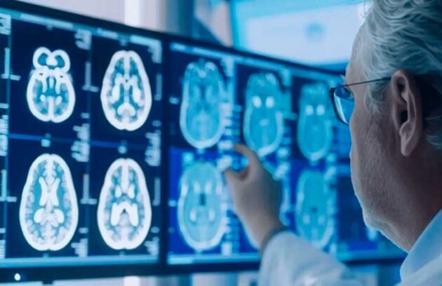 spx-clinica-spx-imagem-neurologia