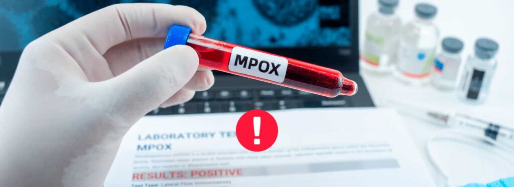 spx-clinica-spx-imagem-variola-dos-macacos-e-emergencia-internacional