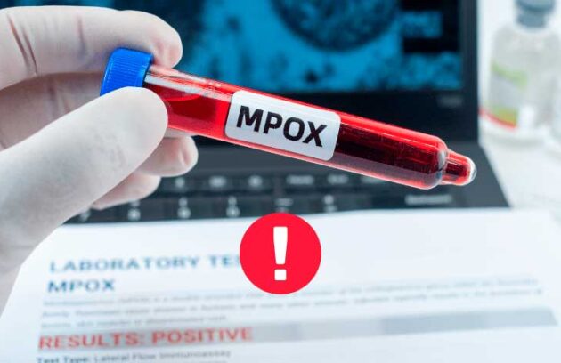 spx-clinica-spx-imagem-variola-dos-macacos-e-emergencia-internacional