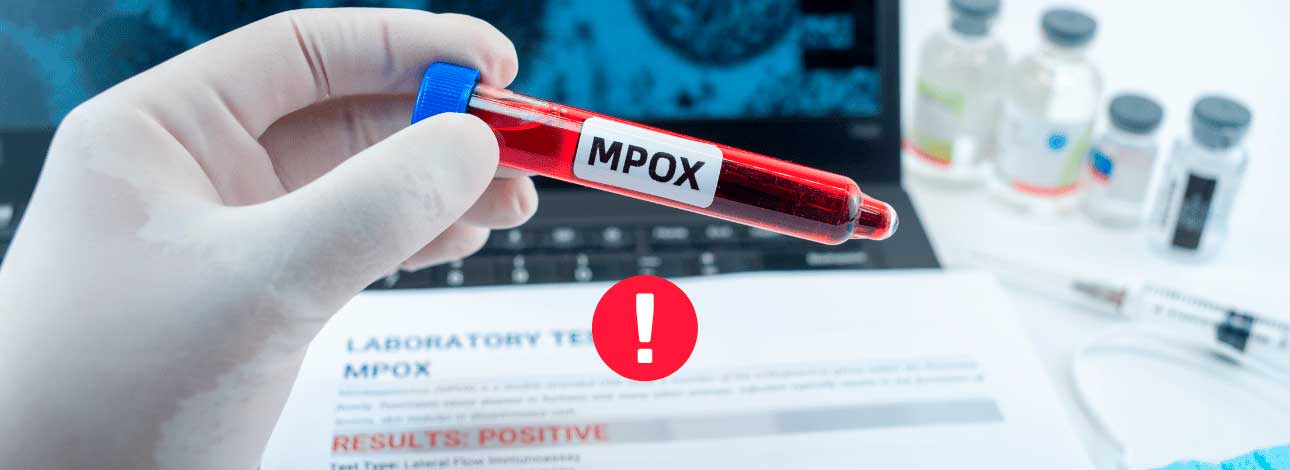 spx-clinica-spx-imagem-variola-dos-macacos-e-emergencia-internacional