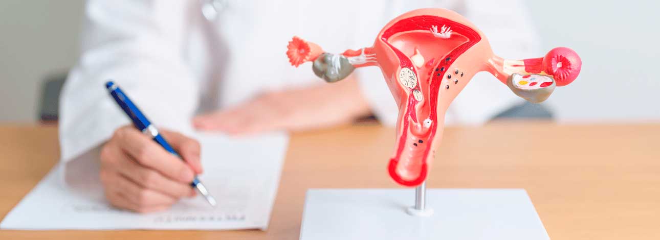 spx-clinica-spx-imagem-4-informacoes-para-compreender-a-endometriose