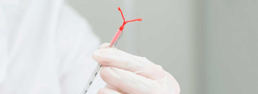 spx-clinica-spx-imagem-aplicacao-e-retirada-de-diu