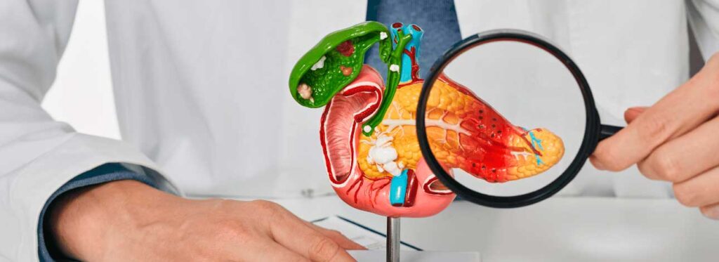 spx-clinica-spx-imagem-dieta-cetogenica-auxilia-no-tratamento-de-cancer-de-pancreas