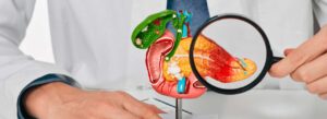 spx-clinica-spx-imagem-dieta-cetogenica-auxilia-no-tratamento-de-cancer-de-pancreas