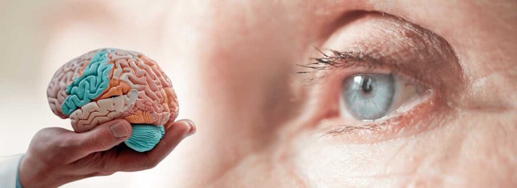 spx-clinica-spx-imagem-sinais-de-alzheimer-nos-olhos