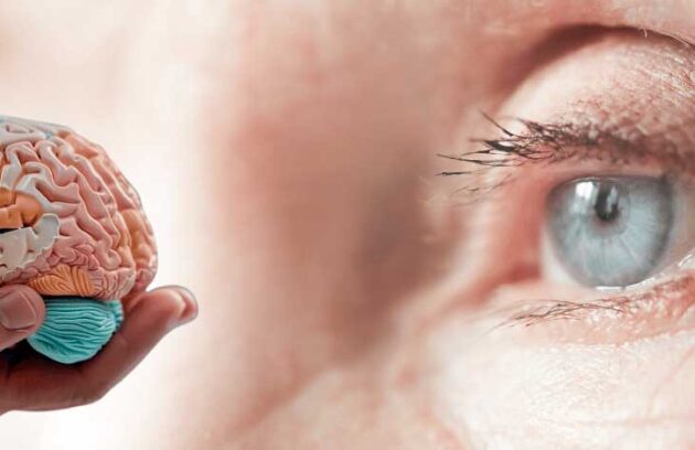 spx-clinica-spx-imagem-sinais-de-alzheimer-nos-olhos
