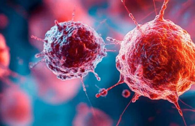 spx-clinica-spx-imagem-tratamento-promissor-contra-cancer-de-intestino