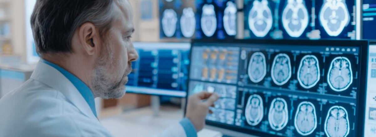 spx-clinica-spx-imagem-tratamento-promissor-para-cancer-de-cerebro-agressivo