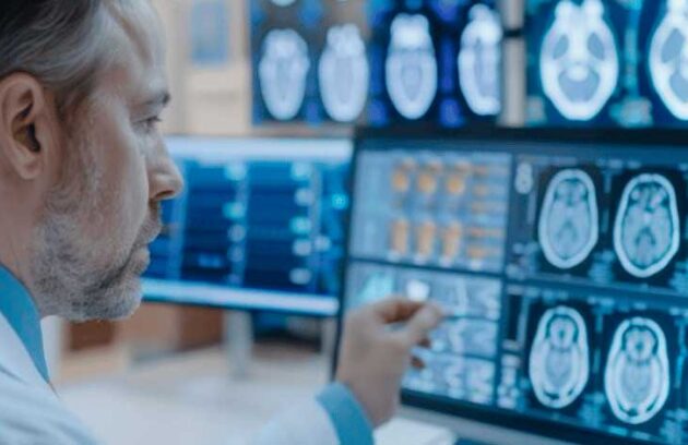 spx-clinica-spx-imagem-tratamento-promissor-para-cancer-de-cerebro-agressivo