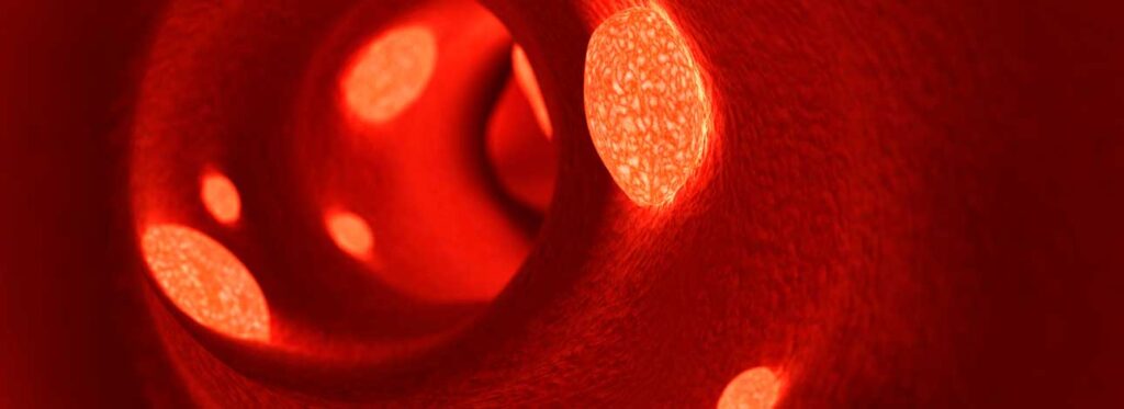 spx-clinica-spx-imagem-glicose-alta-pode-causar-trombose