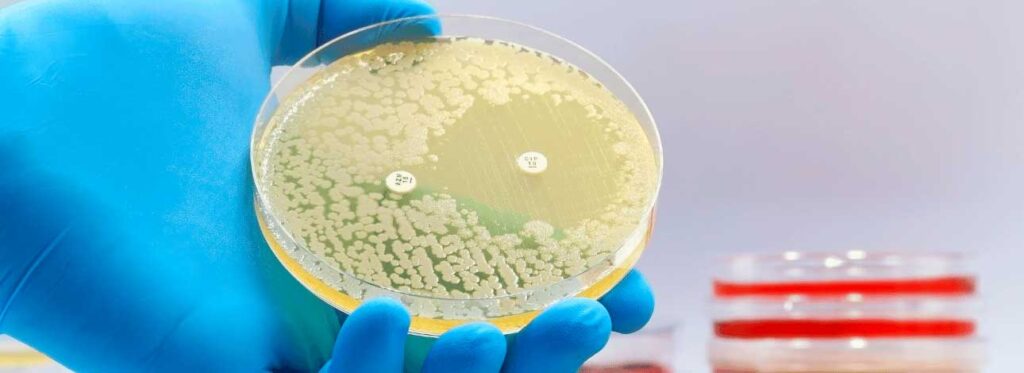 spx-clinica-spx-imagem-resistencia-a-antibioticos-pode-matar-39-milhoes