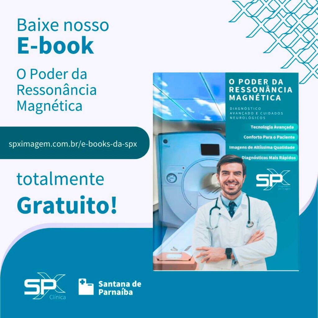 BAixe nosso Eboo de Ressonancia Magnetica