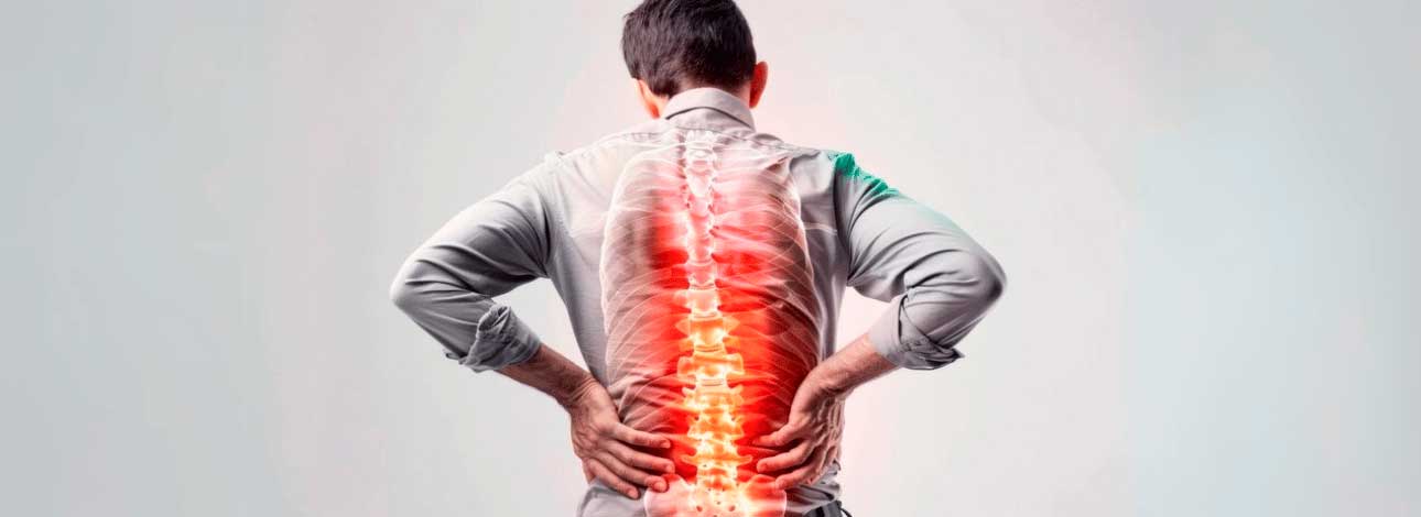 spx-clinica-spx-imagem-como-identificar-os-sintomas-de-escoliose