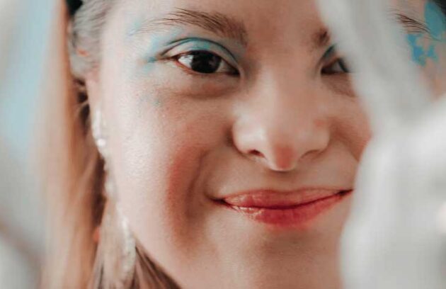 spx-clinica-spx-imagem-demencia-na-sindrome-de-down