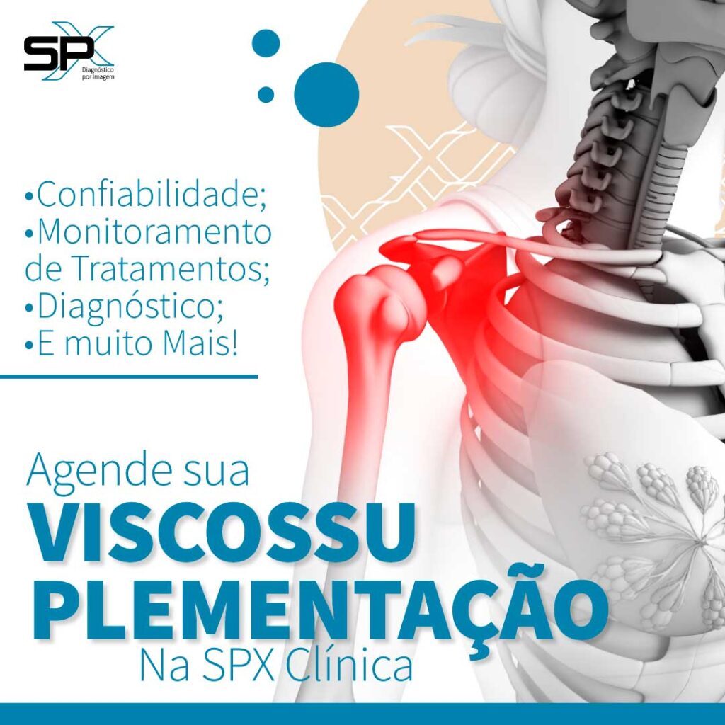 viscossuplementacao-SPX-IMAGEM-SPX-CLINICA