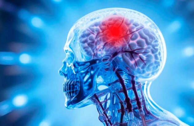 spx-clinica-spx-imagem-bebida-pode-reduzir-o-cortex-cerebral