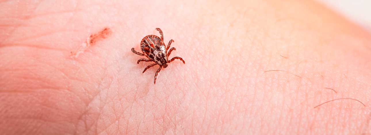 spx-clinica-spx-imagem-descoberta-virus-cerebral-transmitido-por-carrapato