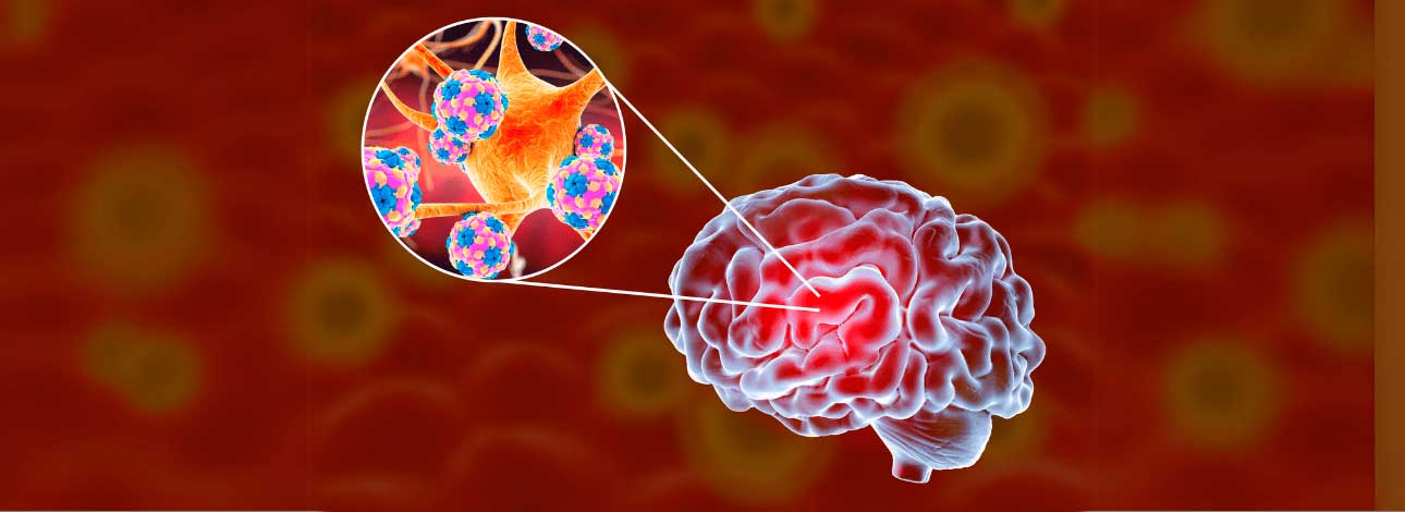 spx-clinica-spx-imagem-infeccoes-virus-cerebral-transmitido-por-carrapato