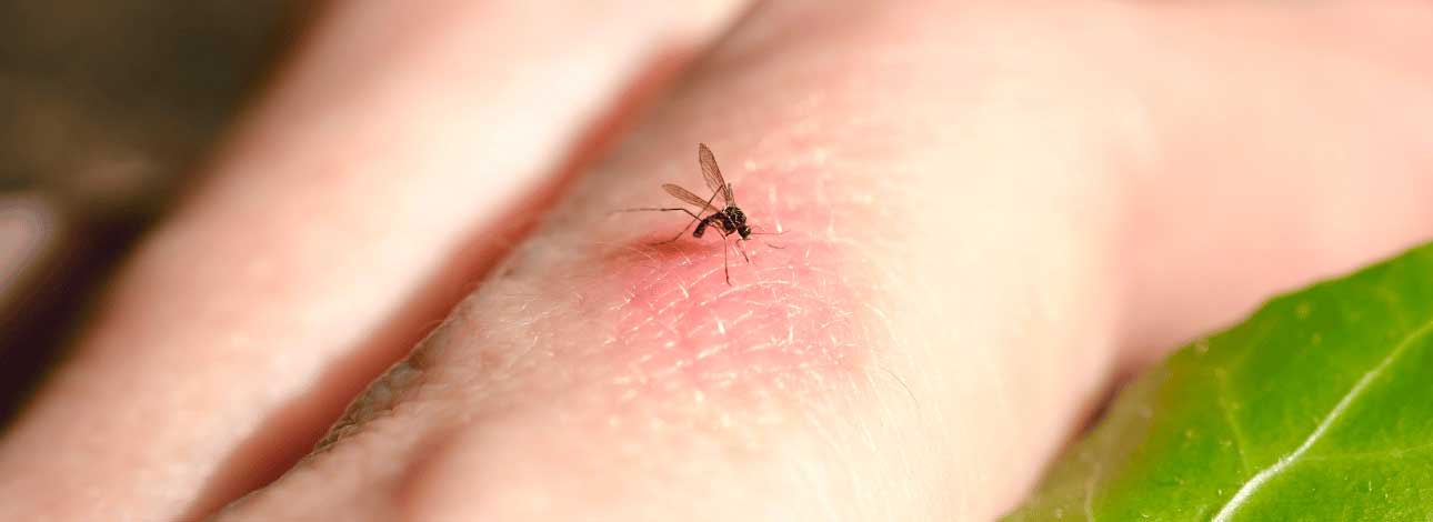 spx-clinica-spx-imagem-presenca-de-mosquitos-no-verao