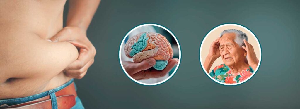 spx-clinica-spx-imagem-relacao-entre-gordura-abdominal-e-alzheimer
