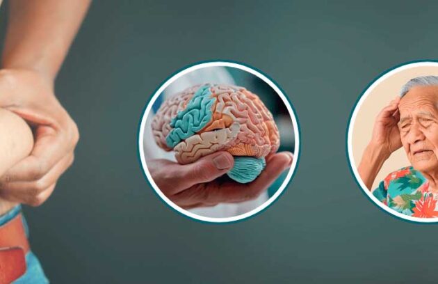 spx-clinica-spx-imagem-relacao-entre-gordura-abdominal-e-alzheimer