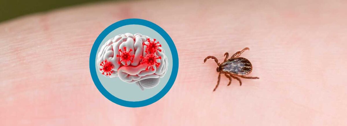 spx-clinica-spx-imagem-virus-cerebral-transmitido-por-carrapato