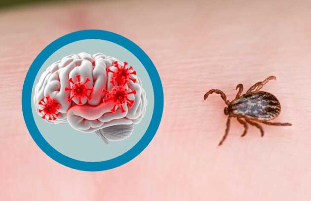 spx-clinica-spx-imagem-virus-cerebral-transmitido-por-carrapato