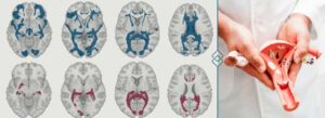 spx-clinica-spx-imagem-como-o-ciclo-menstrual-pode-afetar-o-cerebro