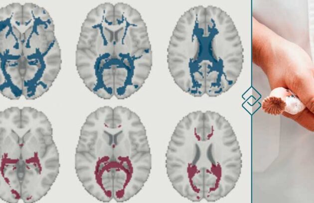 spx-clinica-spx-imagem-como-o-ciclo-menstrual-pode-afetar-o-cerebro