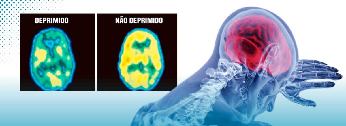 spx-clinica-spx-imagem-depressao-pode-causar-danos-ao-cerebro