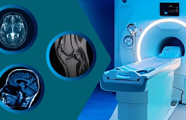 spx-clinica-spx-imagem-condicoes-que-a-ressonancia-magnetica-detecta