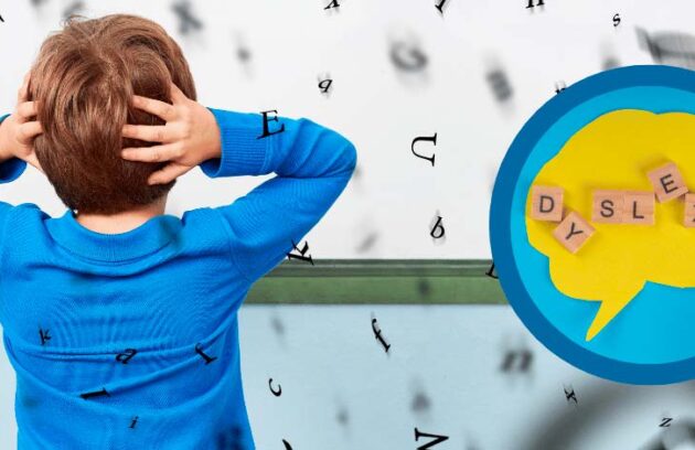 spx-clinica-spx-imagem-impacto-da-dislexia-no-cerebro