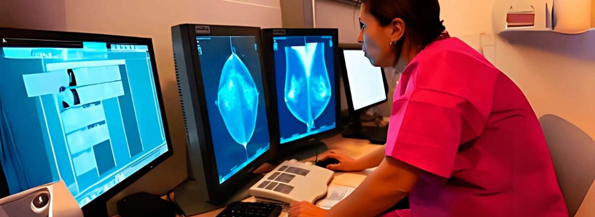 spx-clinica-spx-imagem-novo-metodo-promissor-para-tratar-cancer-de-mama