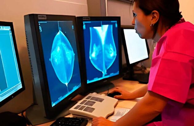 spx-clinica-spx-imagem-novo-metodo-promissor-para-tratar-cancer-de-mama