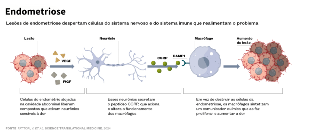 spx-clinica-spx-imagem-endometriose-pode-provocar-dores-intensas-capa