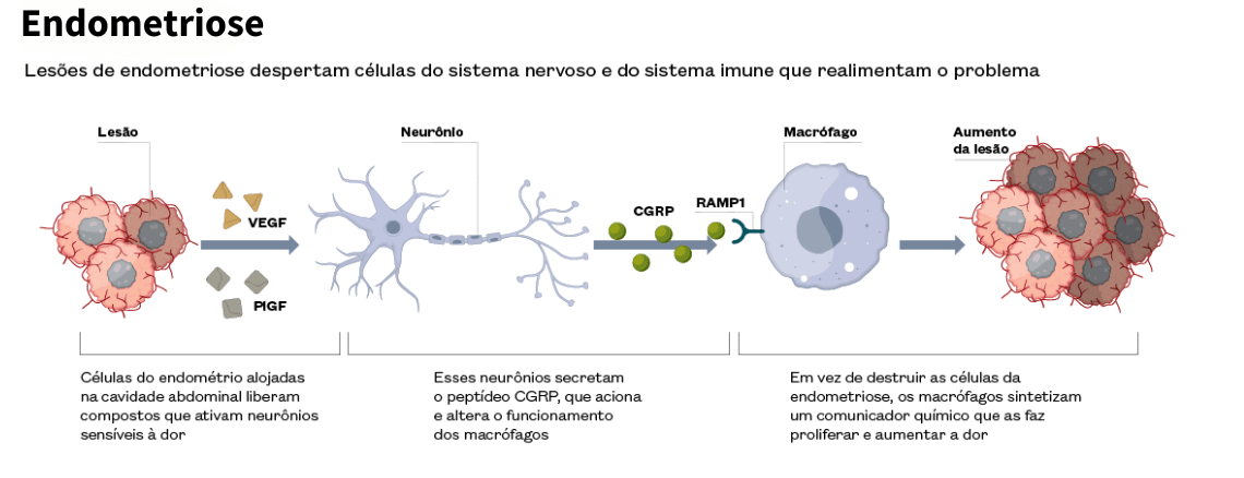 spx-clinica-spx-imagem-endometriose-pode-provocar-dores-intensas-capa