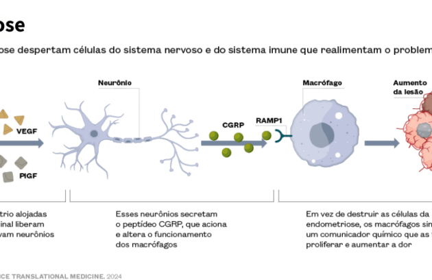 spx-clinica-spx-imagem-endometriose-pode-provocar-dores-intensas-capa